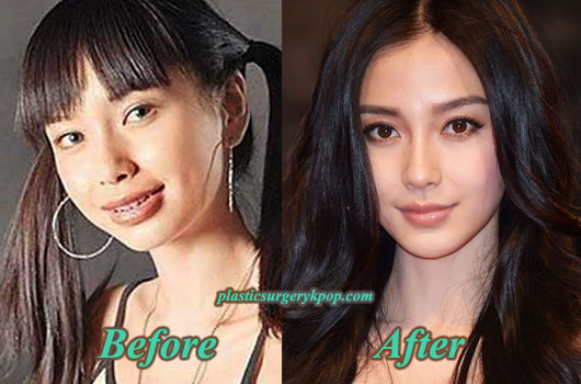 Angelababy-Plastic-Surgery-Before-After.jpg